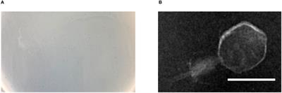 A Novel Acinetobacter baumannii Bacteriophage Endolysin LysAB54 With High Antibacterial Activity Against Multiple Gram-Negative Microbes